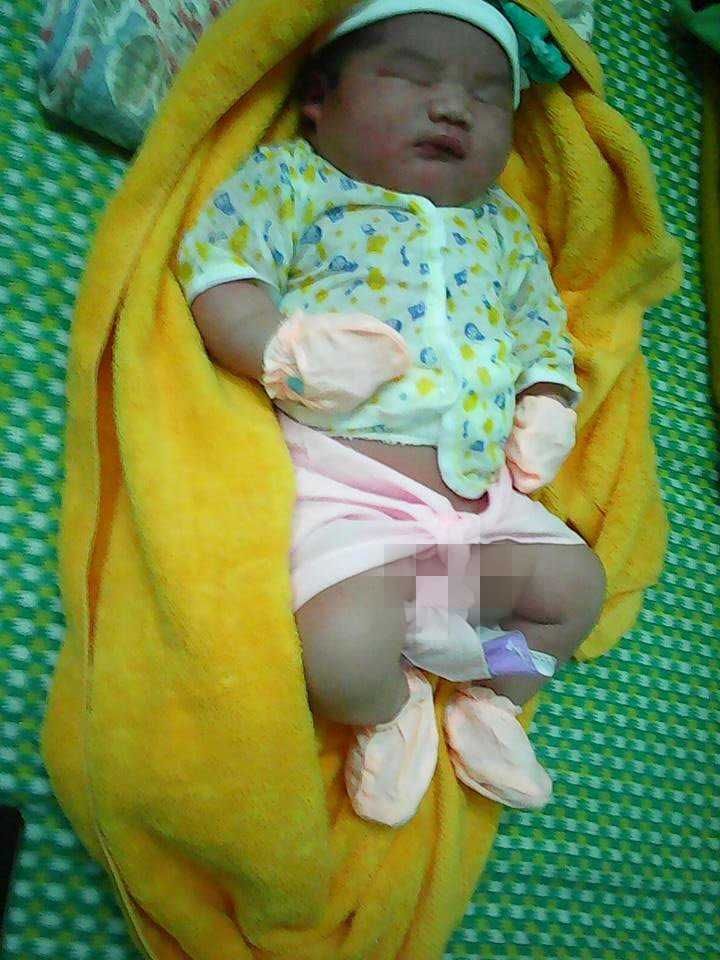 Bé trai sơ sinh nặng 5,1kg. Ảnh: B.T.