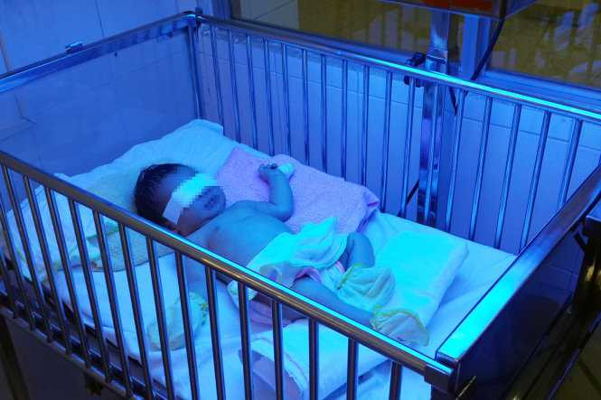 Bé G. đang được điều trị tại khoa Sơ sinh, Bệnh viện nhi đồng Đồng Nai - Ảnh: A.L