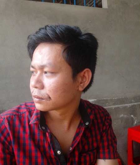 Nạn nhân bị cắn rách môi