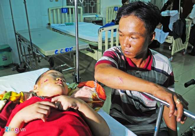 Tài xế xe khách Nguyễn Trọng Quỳnh (ngụ huyện Đakrong, tỉnh Quảng Trị) bị thương nặng ở mặt. Do mất lái, xe của tôi lao xuống vực, vô lăng đập mạnh vào mặt gây chảy máu mũi, trầy xước vùng trán. Tôi đã dùng búa thoát hiểm cùng người dân phá kính đưa mọi người thoát ra ngoài, ông Quỳnh cho hay. 