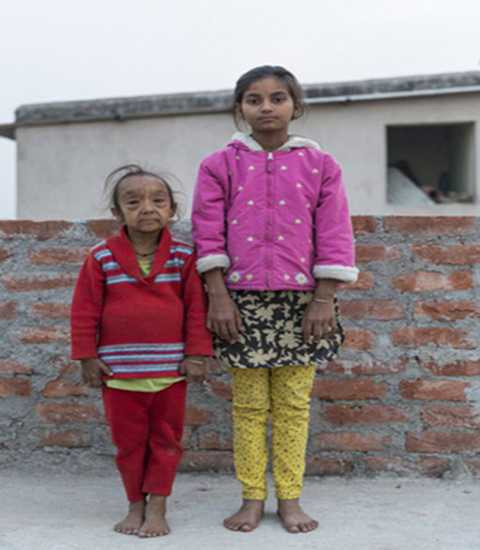 Anjali và chị cả Shilpi miễn nhiễm với căn bệnh lạ. Ảnh Daily Mail Anjali và chị cả Shilpi miễn nhiễm với căn bệnh lạ. Ảnh Daily Mail