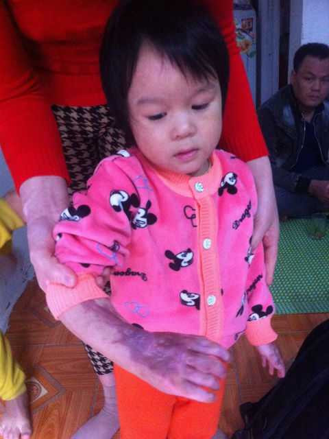 Nổ khí gas sập nhà, 4 người nhập viện: Gia đình trẻ giờ sống ra sao?