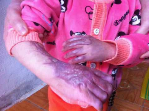 Nổ khí gas sập nhà, 4 người nhập viện: Gia đình trẻ giờ sống ra sao?