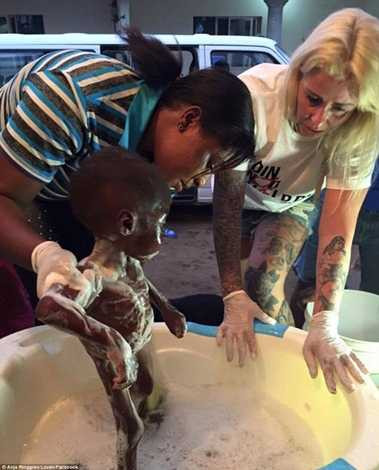 Hope được tắm rửa sạch sẽ sau khi chuyển đến bệnh viện