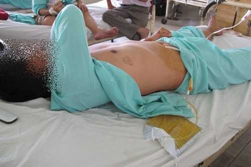 Tráng Thị Hon đã dùng dao cắt của quý của chồng rồi bỏ trốn (Ảnh minh họa)