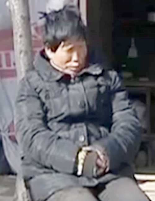 Ding Aihua, người phụ nữ mắc phải căn bệnh kỳ lạ Ding Aihua, người phụ nữ mắc phải căn bệnh kỳ lạ