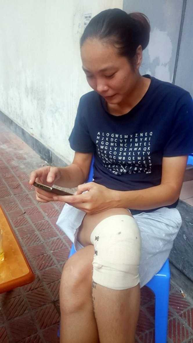 Nụ và chiếc đầu gối tự băng lại để có thể di chuyển được trong những ngày vừa qua khi chấn thương tái phát