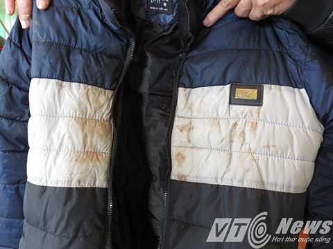 Những chiếc áo đấm máu vẫn được ông Thúy để ở nhà, chưa được cơ quan chức năng lập biên bản thu giữ làm vật chứng 