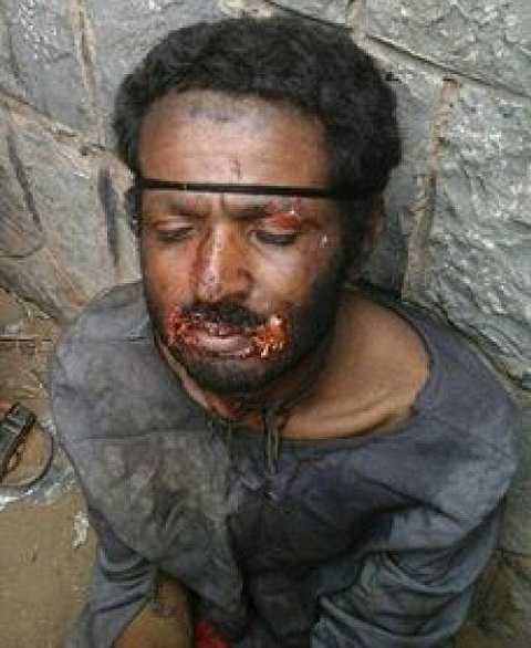 Người đàn ông đang gây xôn xao dư luận Yemen 