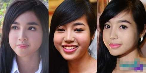 Đôi má phù nề của Elly Trần khiến nhiều người cho rằng cô đã lạm dụng botox để căng da. Đôi má phù nề của Elly Trần khiến nhiều người cho rằng cô đã lạm dụng botox để căng da.