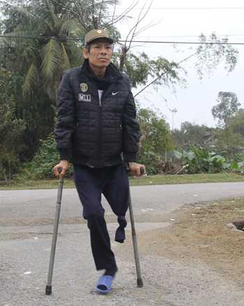 Chiến tranh đã cướp đi một phần xương thịt của ông Chương. Ảnh: Niềm Phạm.