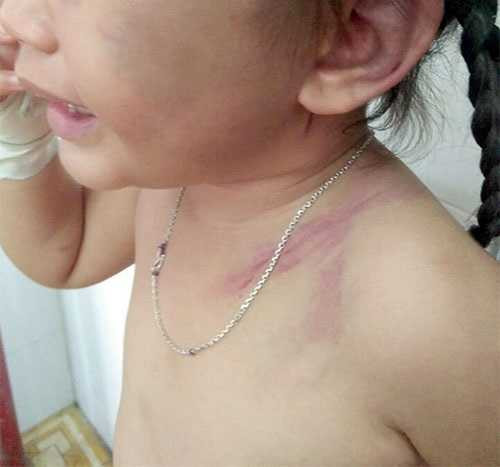 Gã cha dượng bất nhân đánh bé B. không thương tiếc (Ảnh: Báo Bình Thuận)