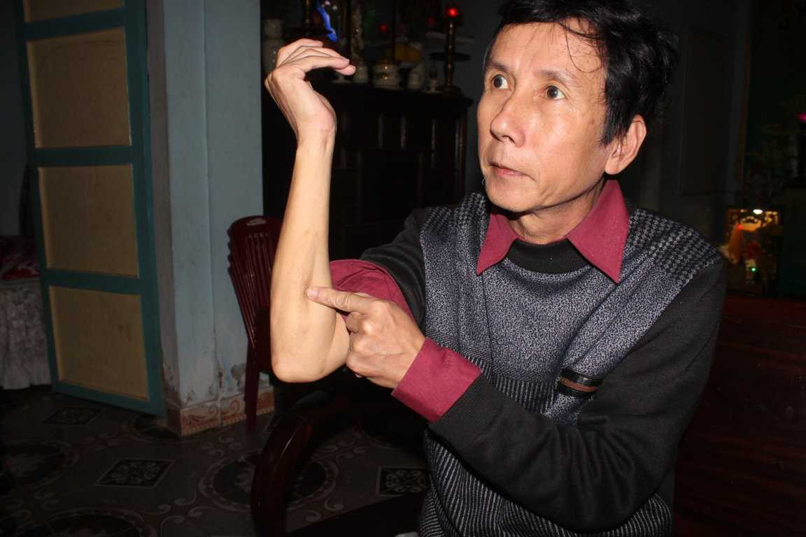 Anh Phụng chỉ vị trí anh bị quân Trung Quốc bắn bị thương ngày 14/3/1988 tại Gạc Ma.