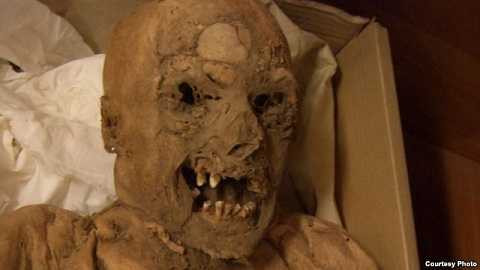 Những xác ướp từ thế kỉ 18 tiết lộ đầu mối về căn bệnh ung thư