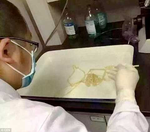 Con sán dây được lấy ra khỏi hệ tiêu hóa Con sán dây được lấy ra khỏi hệ tiêu hóa