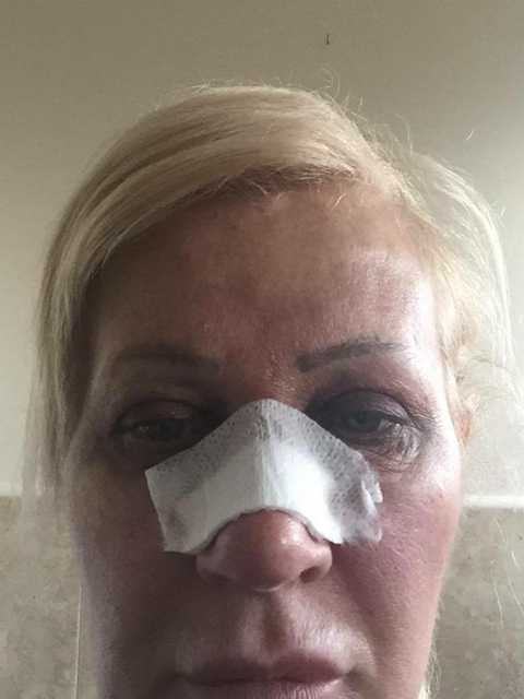 Tổng chi phí các ca phẫu thuật ngực, vùng mắt và mũi là hơn 630 triệu VNĐ. Tổng chi phí các ca phẫu thuật ngực, vùng mắt và mũi là hơn 630 triệu VNĐ.