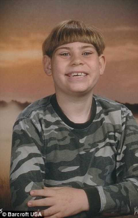 Mái tóc hình nấm che đi dị tật đầu nhỏ