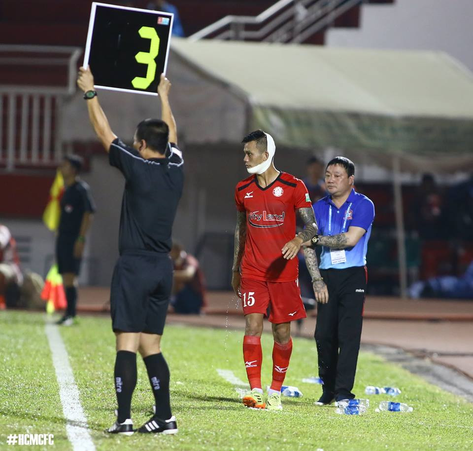 31138105_1323957027737960_2219114635821318144_n 6