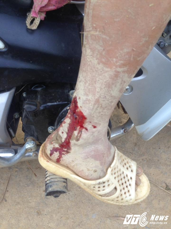 18671222_752191694941107_3857232926437765387_n