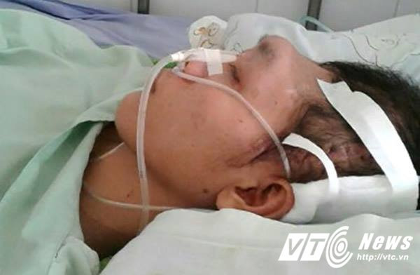 20471810_1420788988014598_1895046478_n 3