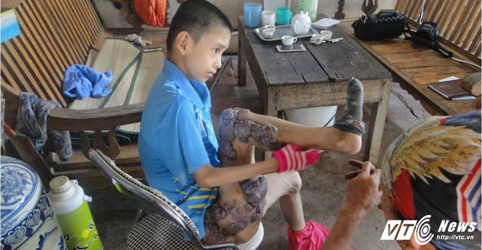 21731147_1444918335626420_43566342034874525_n