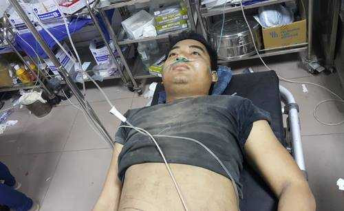 Nạn nhân đang được điều trị tại Bệnh viện 115 Nghệ An. Ảnh: Nam Xuân.