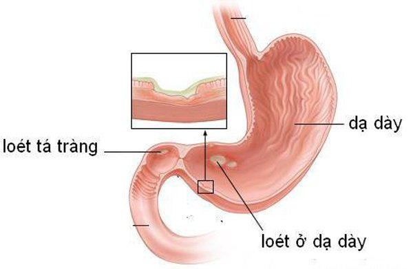 5 kiểu người này tuyệt đối không nên ăn gừng
