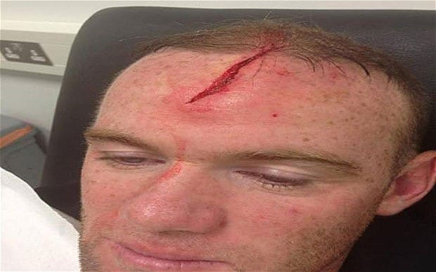 rooney-3