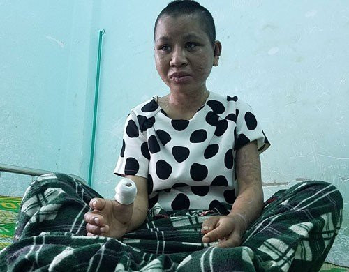 Vụ tra tấn dã man ở Gia Lai: Y Nhiêu về quê điều trị - Ảnh 1.