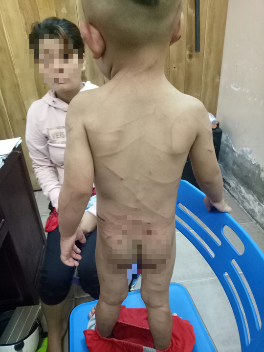 Gã cha dượng đánh dã man con riêng của vợ ở Phú Quốc nghiện ma túy? - Ảnh 2.