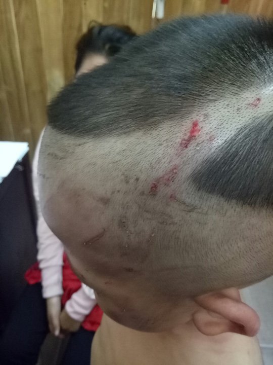Gã cha dượng đánh dã man con riêng của vợ ở Phú Quốc nghiện ma túy? - Ảnh 3.