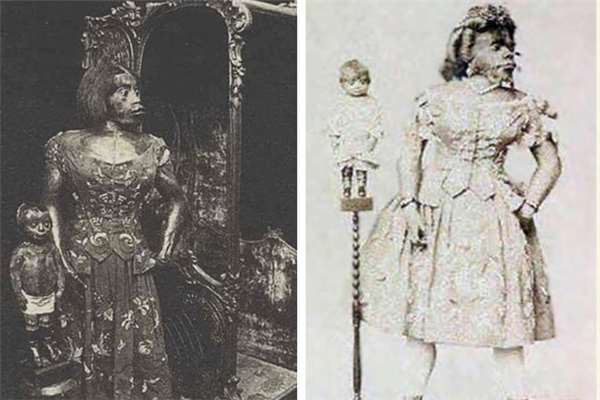 Cuộc đời bất hạnh của người phụ nữ xấu xí nhất thế giới