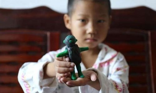 Xúc động cậu bé 8 tuổi 'nhường' sự sống cho em trai vì biết mình sắp ra đi