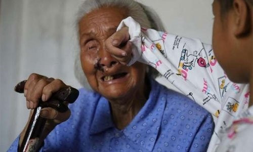 Xúc động cậu bé 8 tuổi 'nhường' sự sống cho em trai vì biết mình sắp ra đi