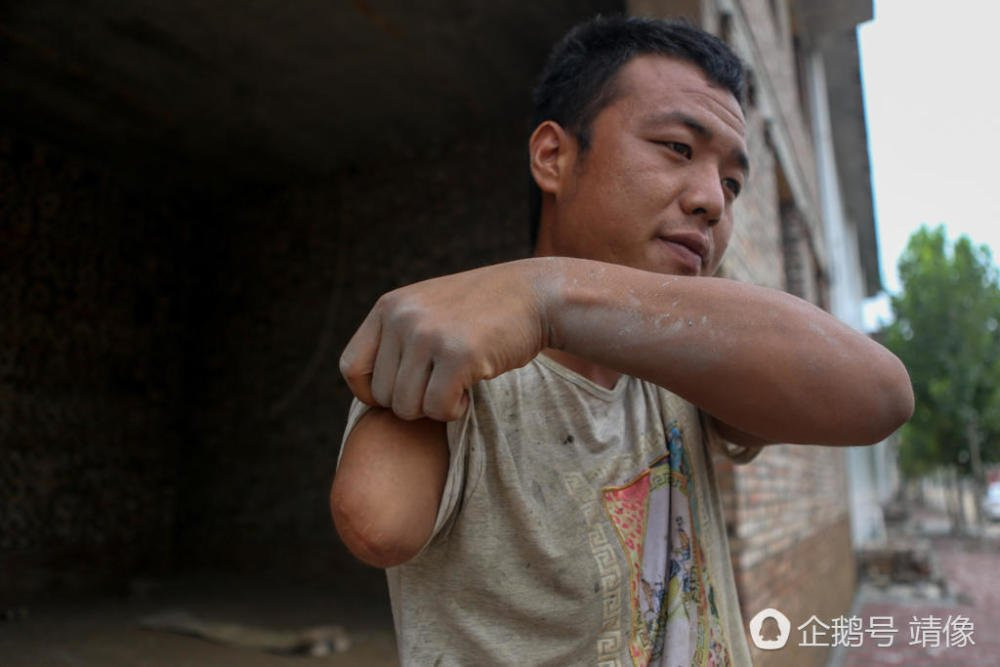 Chàng thợ xây cụt 1 tay đầy nghị lực khiến triệu người nể phục