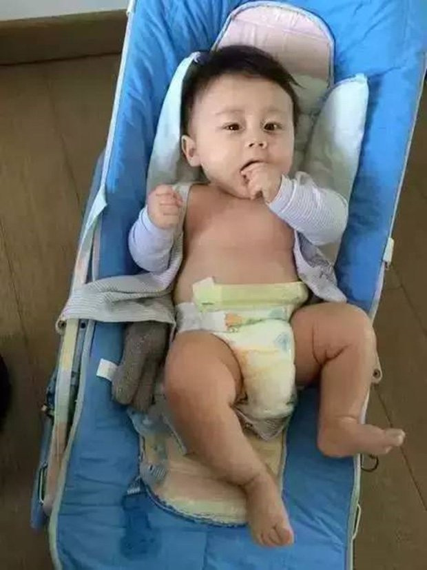 Tủi thân vì con mới sinh quá xấu, bà mẹ trẻ ngỡ ngàng vì sự thay đổi ngoạn mục của con