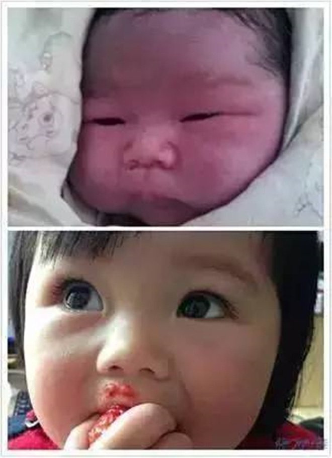 Tủi thân vì con mới sinh quá xấu, bà mẹ trẻ ngỡ ngàng vì sự thay đổi ngoạn mục của con