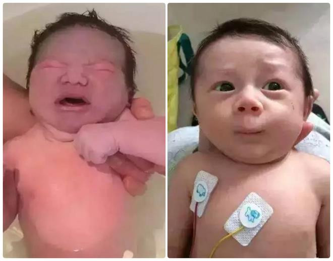 Tủi thân vì con mới sinh quá xấu, bà mẹ trẻ ngỡ ngàng vì sự thay đổi ngoạn mục của con