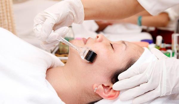 Lăn kim làm đẹp: Liệu có đáng sợ?