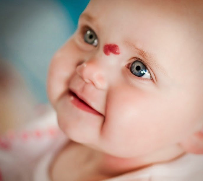 Thấy vết bớt đỏ tưởng nốt ruồi son, mẹ ngã ngửa khi biết đó là trọng bệnh