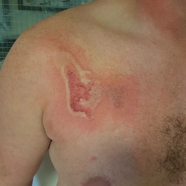 Xúc động khi biết lý do cha và con gái đều có vết sẹo giống nhau trên ngực