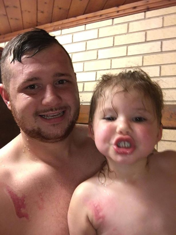 Xúc động khi biết lý do cha và con gái đều có vết sẹo giống nhau trên ngực