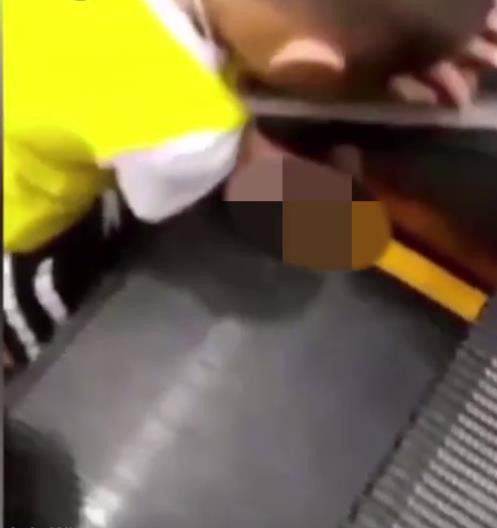 Bất cẩn khi đi thang cuốn cùng mẹ, cậu bé suýt đứt lìa tay