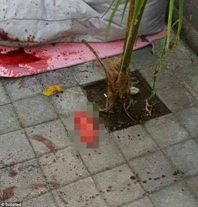 Lên cơn cuồng ghen, chồng nhẫn tâm chặt chân vợ trước mặt con