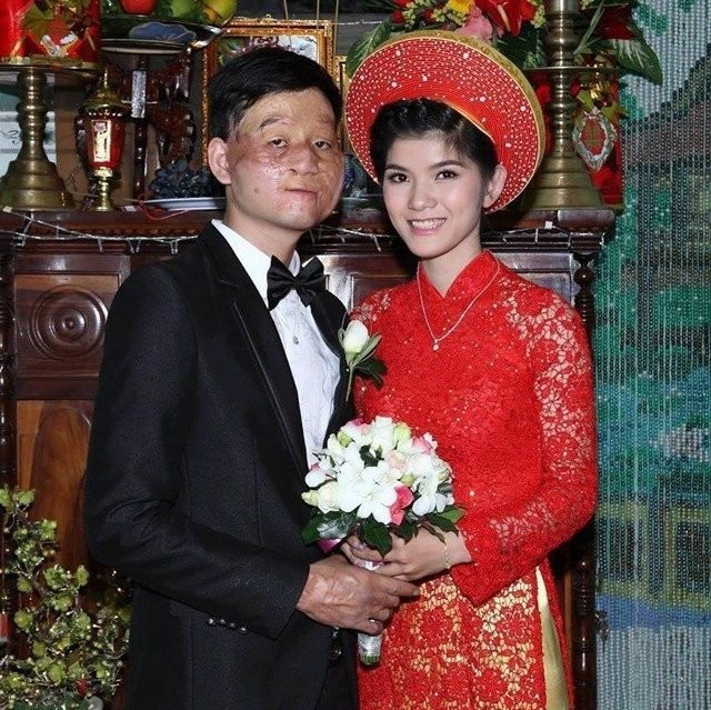 Điểm mặt những đám cưới 'lệch pha' khiến ai nấy đều xúc động vì tình yêu chân thành