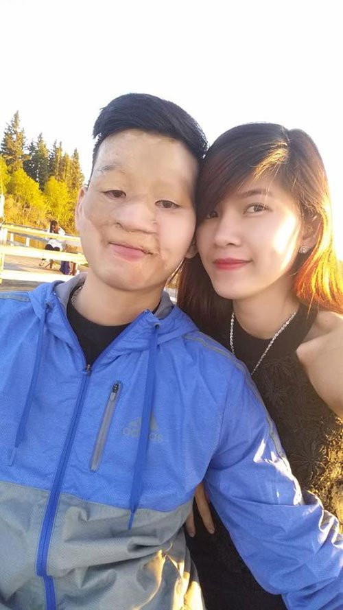 Điểm mặt những đám cưới 'lệch pha' khiến ai nấy đều xúc động vì tình yêu chân thành