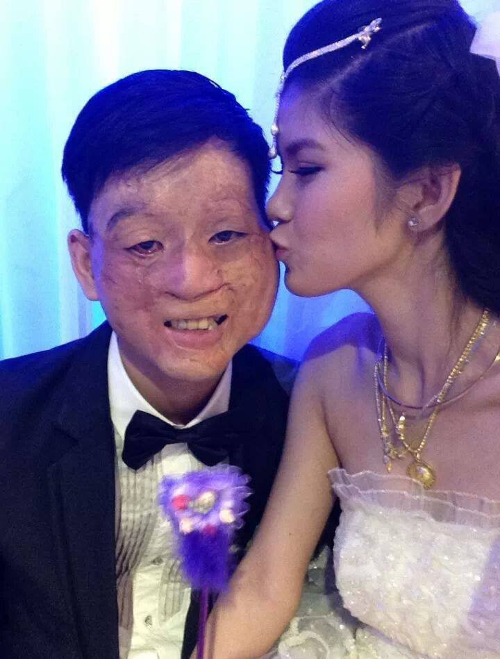 Điểm mặt những đám cưới 'lệch pha' khiến ai nấy đều xúc động vì tình yêu chân thành