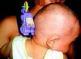 Bé trai bị đồ chơi găm vào đầu, thoát chết nhờ bà ngoại nhanh trí