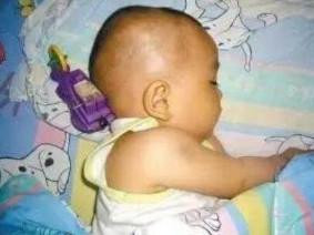 Bé trai bị đồ chơi găm vào đầu, thoát chết nhờ bà ngoại nhanh trí