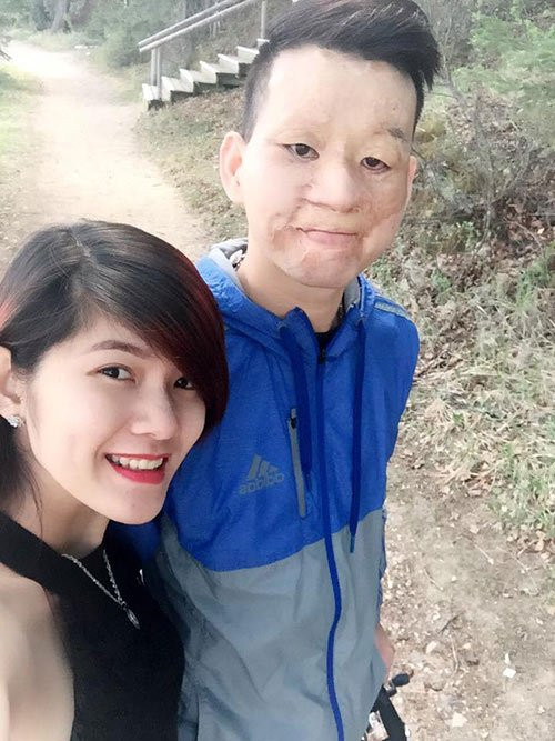 Điểm mặt những đám cưới 'lệch pha' khiến ai nấy đều xúc động vì tình yêu chân thành